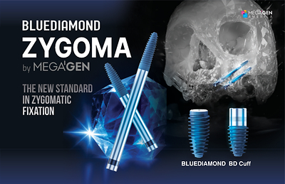 MegaGen Announces Launch of BLUEDIAMOND ZYGOMA Implant at the 2026 NASM Symposium in Chicago