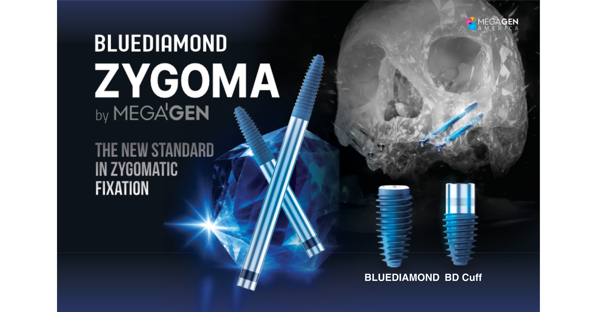 MegaGen Announces Launch of BLUEDIAMOND ZYGOMA Implant at the 2026 NASM Symposium in Chicago