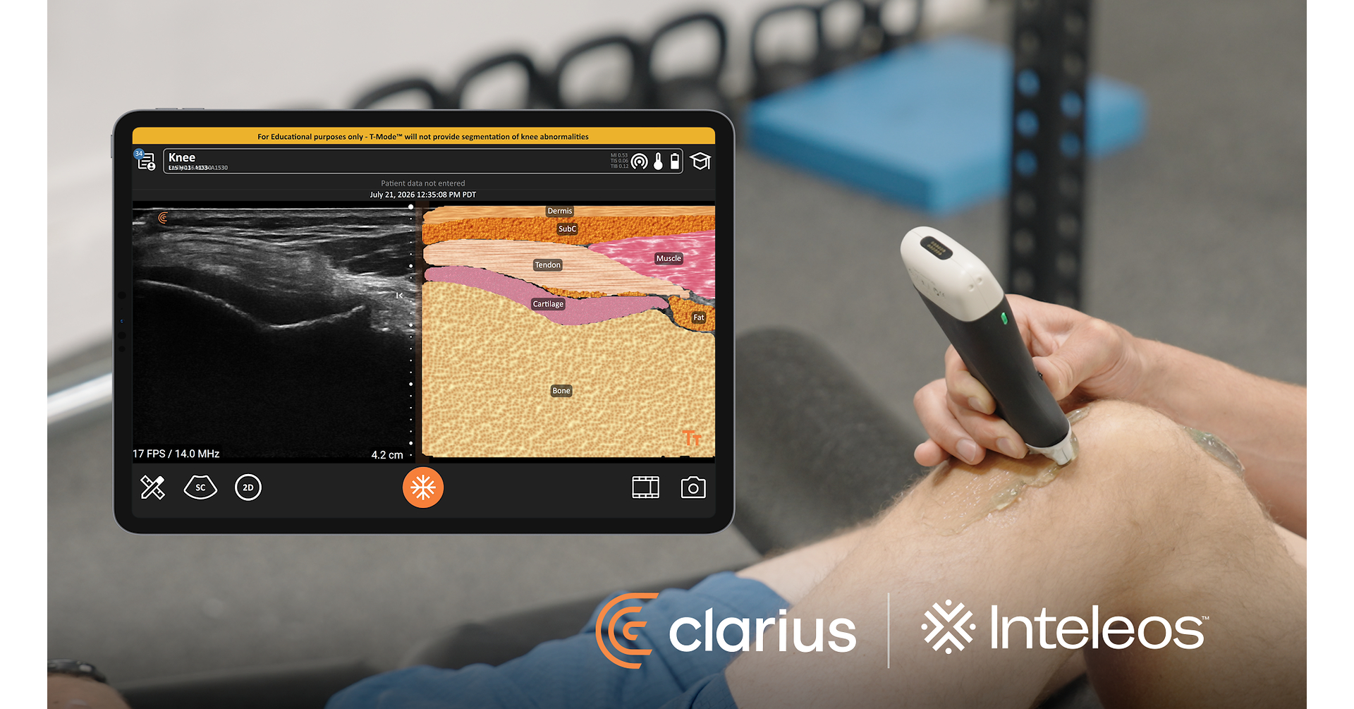Clarius and Inteleos Pair Portable Ultrasound With the POCUS Certification