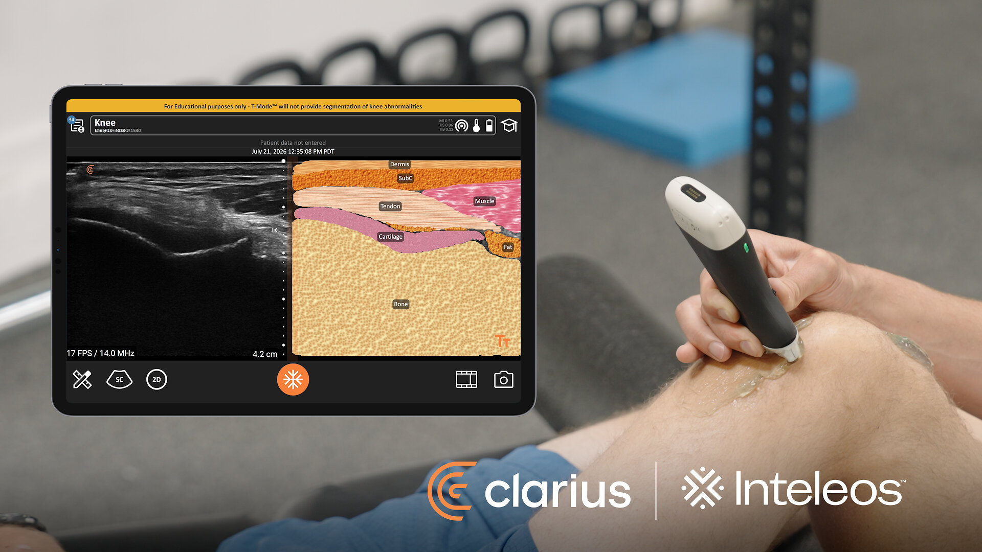 Clarius und Inteleos bündeln portables Ultraschallgerät mit POCUS-Zertifizierung