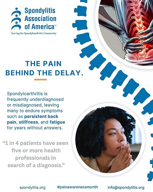 The Pain Behind the Delay