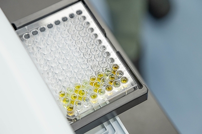 Precision indoxyl sulfate (IS) testing serves as a vital adjunct in assessing renal function, bridging the gap left by traditional biomarkers to secure a critical window for early clinical intervention. (Image: Leadgene Biomedical) Precision indoxyl sulfate (IS) testing serves as a vital adjunct in assessing renal function, bridging the gap left by traditional biomarkers to secure a critical window for early clinical intervention. (Image: Leadgene Biomedical)