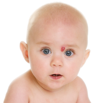 Arkayli Biopharma Inc. Receives Study May Proceed Response to IND from FDA and SBIR Grant from NIH to Advance Clinical Development of ARK001 for a Rare Pediatric Disease