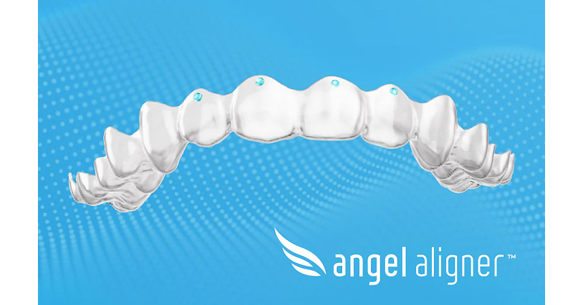 Angel Aligner lance « Pressure Points » en Europe pour remplacer les crêtes de torque par les points de pression