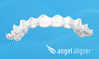 Angel Aligner Upgrades Torque Ridges to "Pressure Points" in Europe
