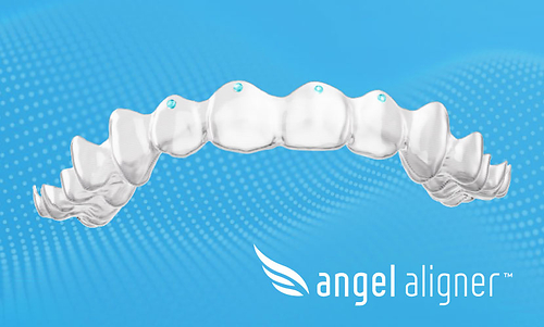 Angelalign Has Already Replaced Torque Ridges with Upgraded “Pressure Points” in Europe Angelalign Has Already Replaced Torque Ridges with Upgraded “Pressure Points” in Europe