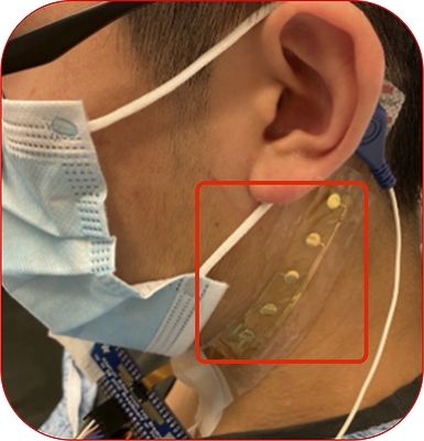 InflammaSense Named Performer on ARPA-H's up to $38 Million CIRCLE Award to Advance Real-Time Immune Monitoring in Critical Care