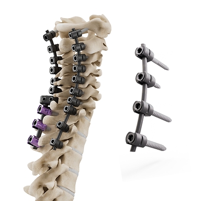 icotec Receives CMS approval for New Technology Add-On Payment for its CMORE® CT System