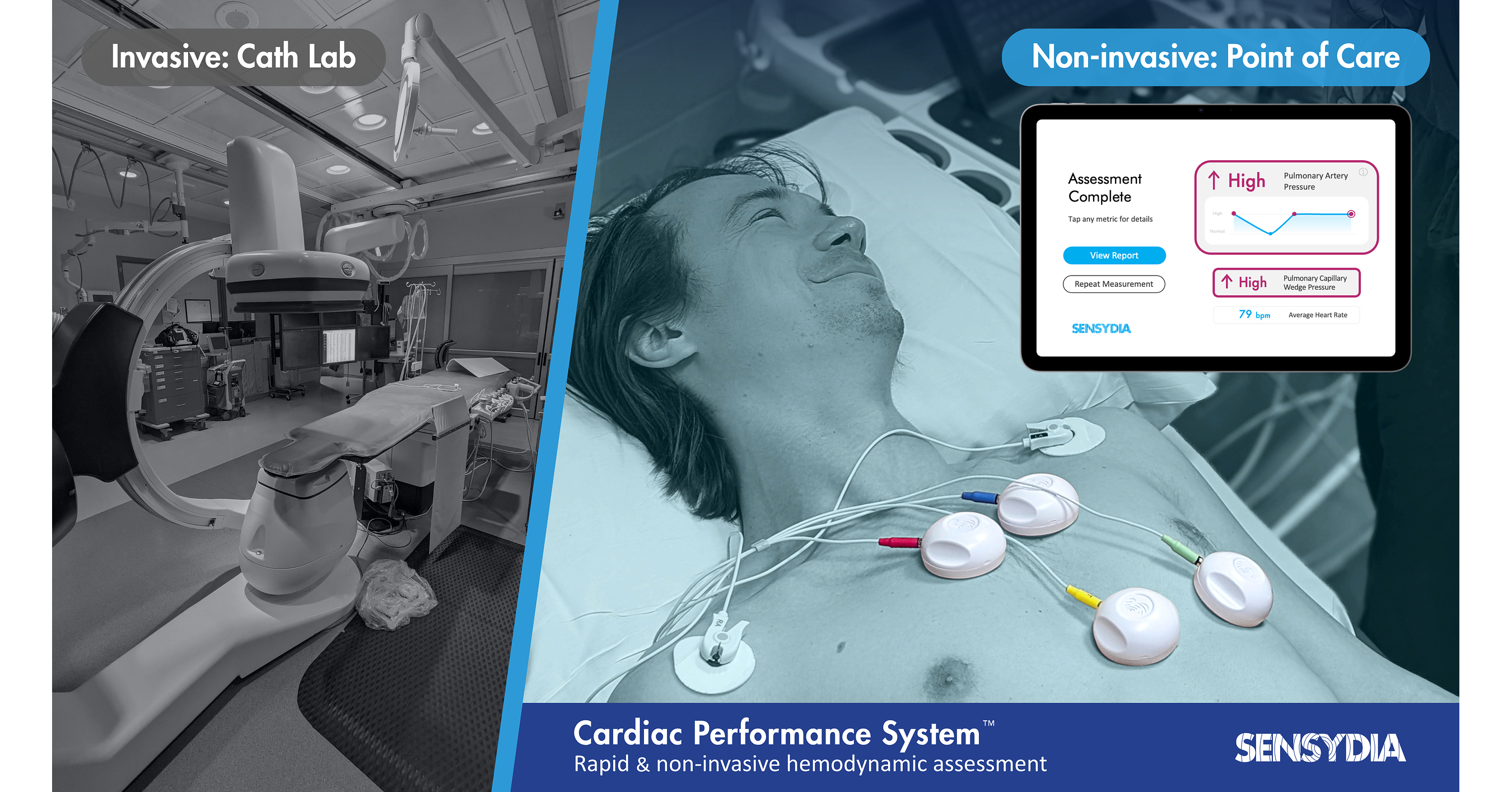 Sensydia Secures Oversubscribed Funding to Deliver Groundbreaking Cardiac Performance System to the Office, Hospital, and Clinic