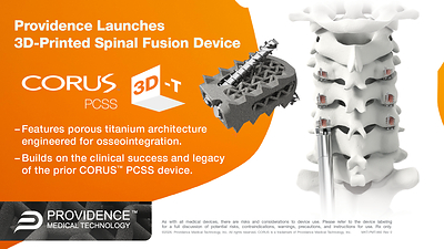 Providence Medical Technology Receives FDA 510(k) Clearance for CORUS™ PCSS 3D-T, Bringing 3D-Printed Porous Titanium to Its Total Segmental Fusion Platform