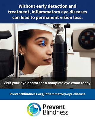 Sixth Annual Inflammatory Eye Disease Week from Prevent Blindness to be Held on Oct. 19-25, 2026