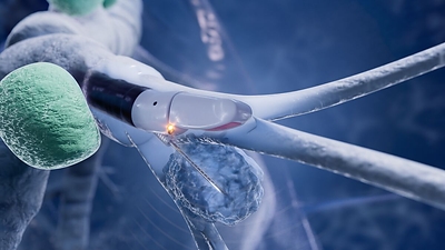 Olympus Announces U.S. Launch of New Peripheral EBUS Bronchoscope