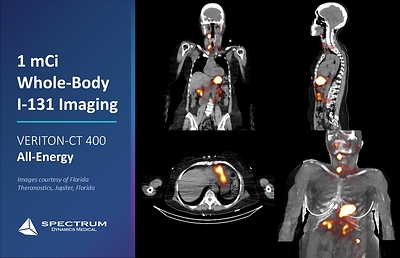 Four Leading Institutions Complete Initial Clinical Experience with Spectrum Dynamics Medical's All-Energy Digital SPECT/CT