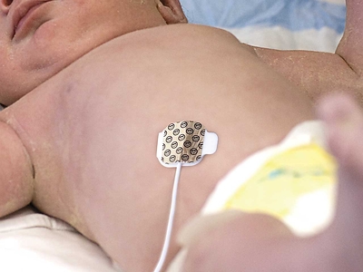 Baby with NeoSmile Plus holding temperature probe in place.