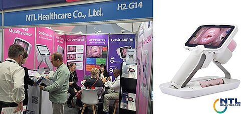 CerviCARE AI on display at WHX Johannesburg 2026 This image opens in the lightbox