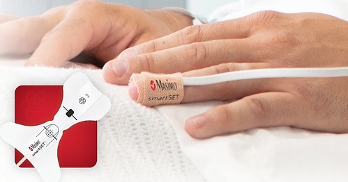 Masimo smartSET™ pulse oximetry with PPG AFib and OIRD Detection Masimo smartSET™ pulse oximetry with PPG AFib and OIRD Detection