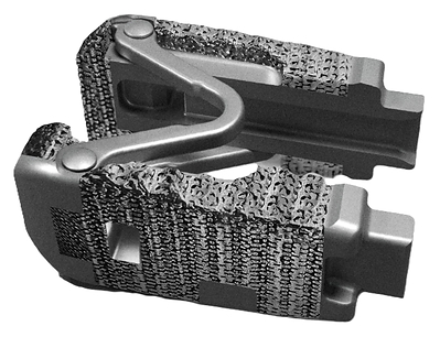 LOGIC Titanium Implant