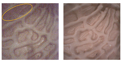 (L) Equivalent to conventional analog output, Graininess and vertical lines are prominent, making details difficult to see
(R) IMX742, Reduces graininess and vertical lines and makes details easy to see