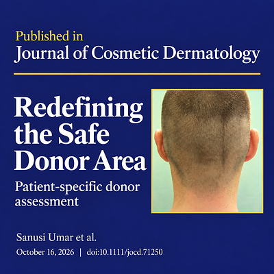 A new review by Sanusi Umar, MD, and colleagues in the Journal of Cosmetic Dermatology examines how individualized scalp assessment may reveal additional hair transplant donor options while identifying areas best avoided.  New hair transplant review challenges fixed donor limits DR U HAIR AND SKIN CLINIC New Review