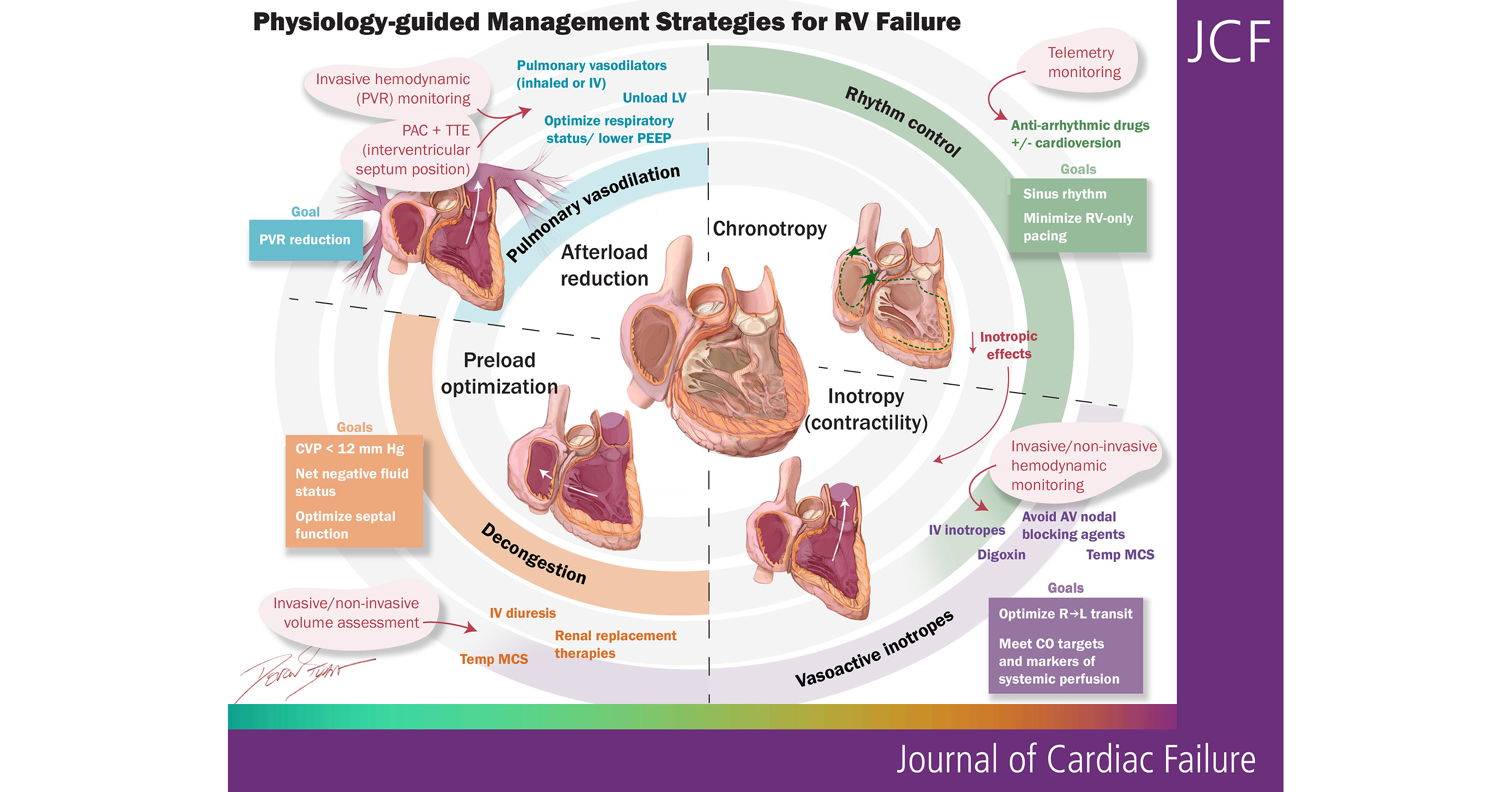 New HFSA Scientific Statement Calls for Right Heart Failure to Be Recognized as a Distinct Clinical Syndrome