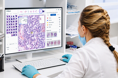 Hyland Digital Pathology, powered by Tribun Health, an enterprise-grade digital pathology solution that ends the clinical, operational, and architectural fragmentation that has kept pathology disconnected from healthcare's digital transformation. Hyland Digital Pathology, powered by Tribun Health, an enterprise-grade digital pathology solution that ends the clinical, operational, and architectural fragmentation that has kept pathology disconnected from healthcare's digital transformation.
