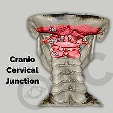 Brain surgeons look for tumors In 1999 I published that the problem was between the head and the neck and that x-rays and C scans and MRIs needed to be taken upright. Brain surgeons look for tumors In 1999 I published that the problem was between the head and the neck and that x-rays and C scans and MRIs needed to be taken upright.