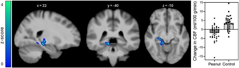 New Research Finds Daily Peanut Consumption Benefits Brain's