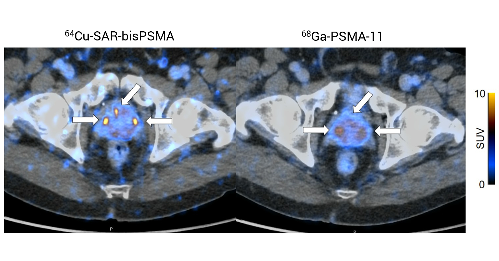 Registrational Phase III CLARIFY trial: Target number of participants achieved