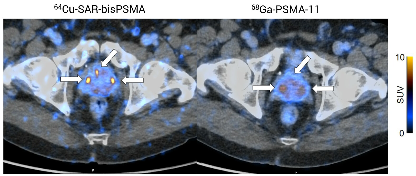 Registrational Phase III CLARIFY trial: Target number of par