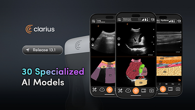 Clarius announces 30 specialized ultrasound AI models integrated into Clarius App 13.1, the industry's largest publicly documented integrated AI-model portfolio. Clarius announces 30 specialized ultrasound AI models integrated into Clarius App 13.1, the industry's largest publicly documented integrated AI-model portfolio.