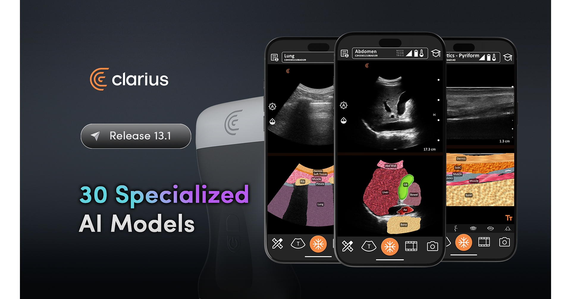 Clarius Leads Handheld Ultrasound AI with Industry's Largest Integrated Portfolio of 30 Models
