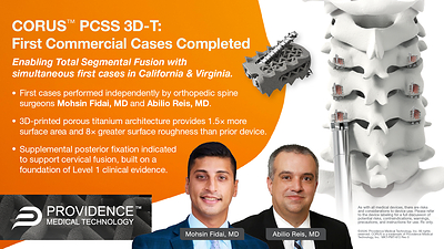 Providence Medical Technology Announces First Commercial Cases Using Next-Generation, 3D-Printed CORUS™ Posterior Cervical Stabilization System (PCSS 3D-T)