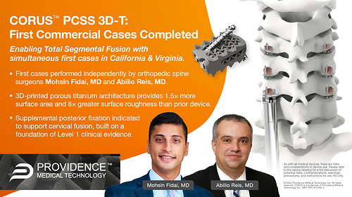 The first commercial cases utilizing the 3D-printed CORUS™ PCSS 3D-T are complete on both coasts. Engineered with a proprietary porous titanium lattice that delivers 1.5x more surface area and 8x the surface roughness of the original machined implant, it builds on the Level 1 clinical evidence for CORUS PCSS to enable Total Segmental Fusion across all three joints of the spinal segment. The first commercial cases utilizing the 3D-printed CORUS™ PCSS 3D-T are complete on both coasts. Engineered with a proprietary porous titanium lattice that delivers 1.5x more surface area and 8x the surface roughness of the original machined implant, it builds on the Level 1 clinical evidence for CORUS PCSS to enable Total Segmental Fusion across all three joints of the spinal segment.