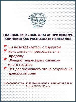 The ISHRS has created free resources for patients to make the right choice when seeking a hair transplant surgeon. The ISHRS has created free resources for patients to make the right choice when seeking a hair transplant surgeon.