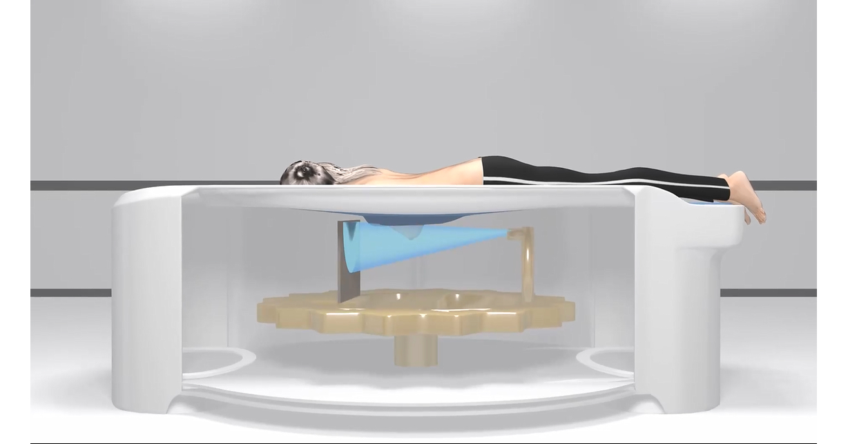 Koning Health Announces Australian Regulatory Approval for Koning Breast CT System